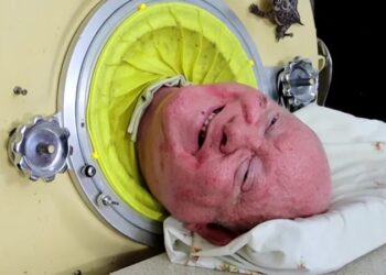 Falleció Paul Alexander a los 78 años