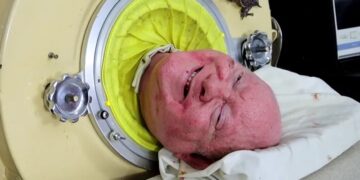 Falleció Paul Alexander a los 78 años