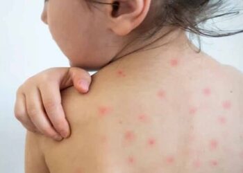 Alerta por sarampión y nueva variante de dengue en Tamaulipas