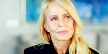 Cecilia Bolocco, muestra lesiones en la piel tras un tratamiento