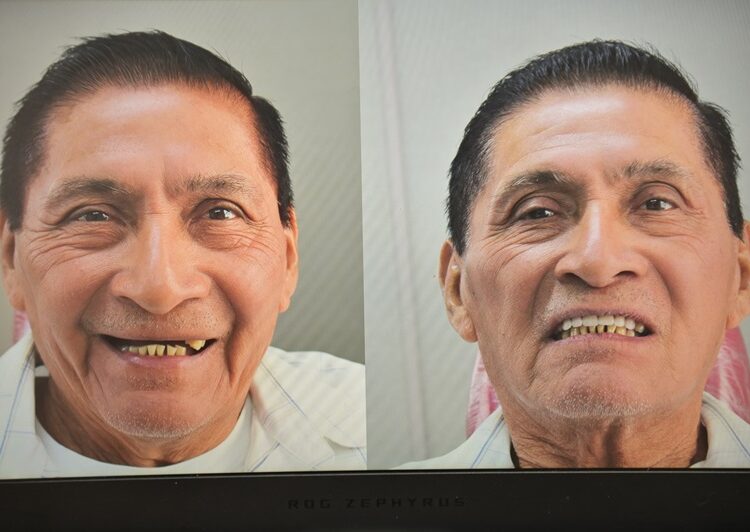 Consolida Mónica Villarreal programa municipal de salud bucal