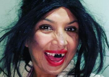 Fui víctima de racismo en Estados Unidos: “La Chupitos»