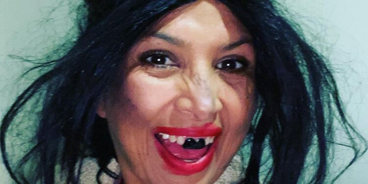 Fui víctima de racismo en Estados Unidos: “La Chupitos»