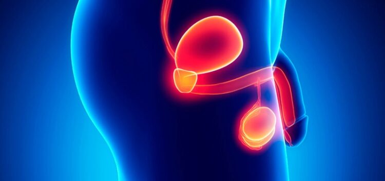 11 de junio, ‘Día Mundial del Cáncer de Próstata’