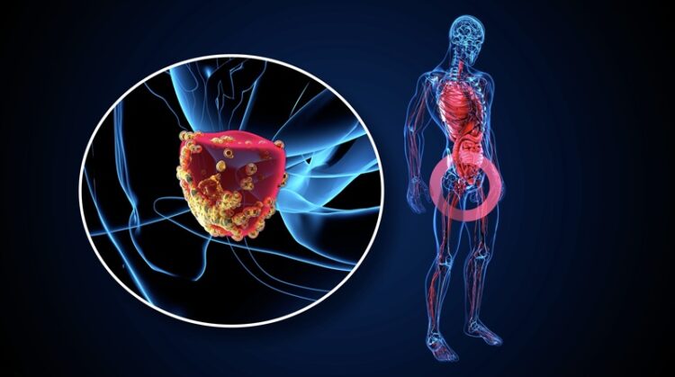 11 de junio, ‘Día Mundial del Cáncer de Próstata’