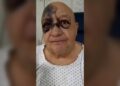 Luis de Alba sufrió caída en su casa y aclara su estado de salud