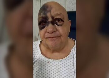 Luis de Alba sufrió caída en su casa y aclara su estado de salud