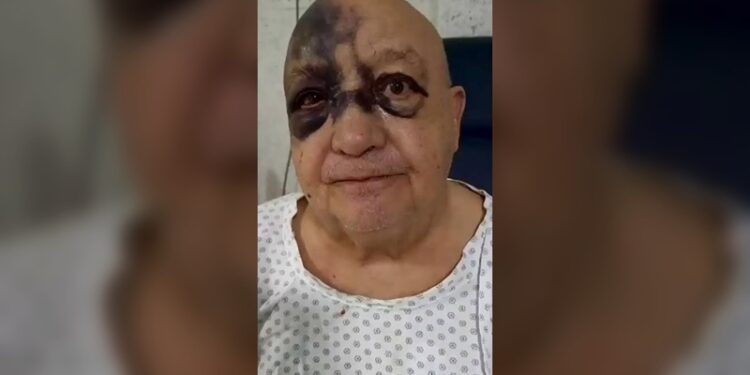Luis de Alba sufrió caída en su casa y aclara su estado de salud