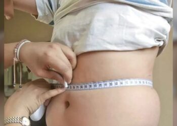 Tamaulipas rebasa los 9 mil casos de obesidad en lo que va de 2026